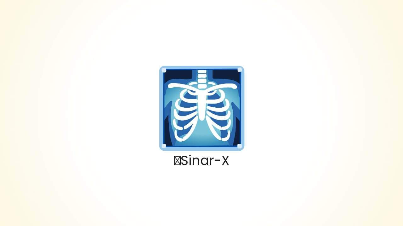 X-Ray